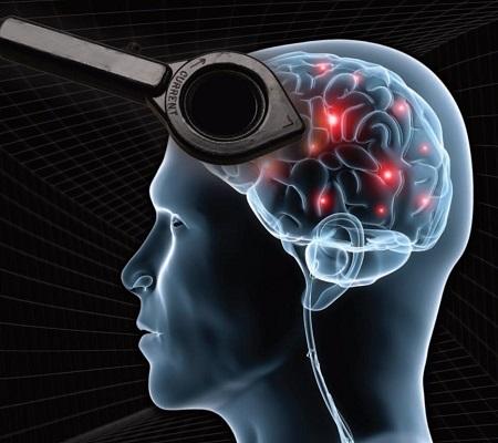 择思达斯:治疗癫痫的方法有哪些?