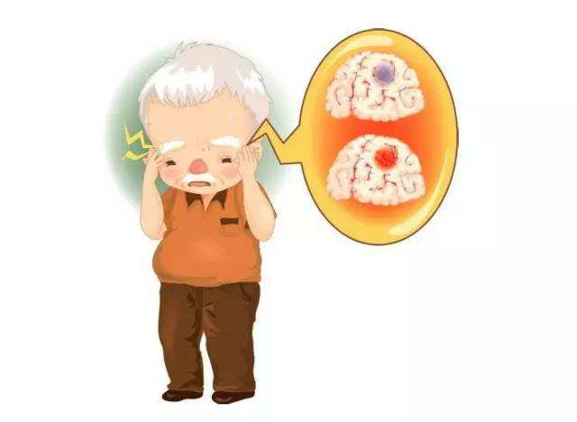 引发脑出血的这个5个诱因一定要牢记!-经颅磁治疗仪 