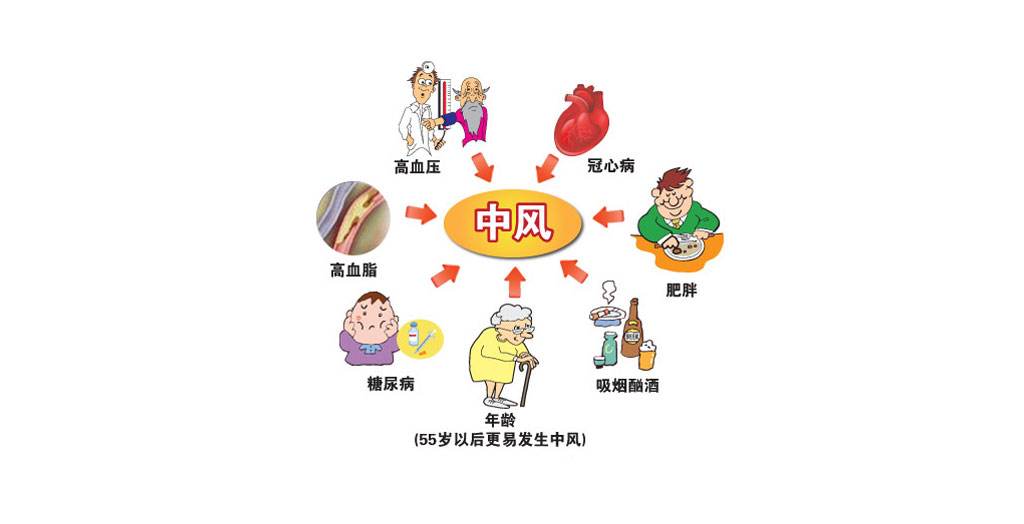 经颅磁治疗仪 教您一招鉴别脑中风前兆