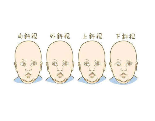 经颅磁对儿童的治疗_孩子有脑瘫怎么训练