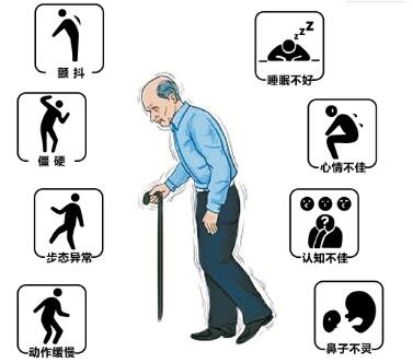 经颅磁刺激仪治疗效果|帕金森的常见误解有什么 