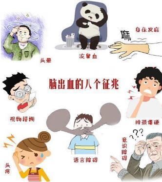 经颅磁刺激仪治疗效果_脑出血通常什么时候可以恢复 