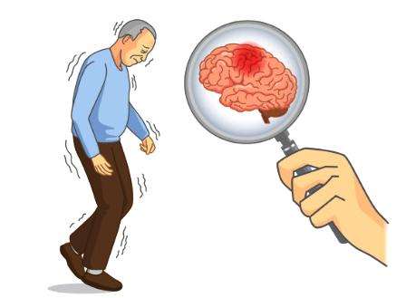 rtms经颅磁治疗仪_帕金森和老年痴呆一样吗