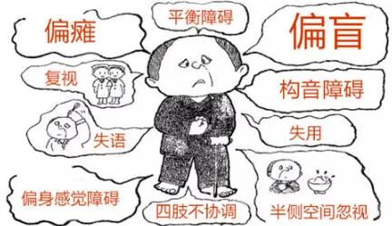 经颅磁刺激_脑中风最常见的症状是什么 