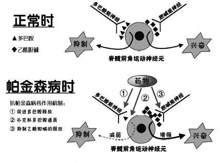 择思达斯经颅磁刺激仪|治疗帕金森需要多少钱 