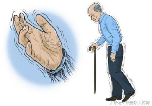 帕金森病治疗新武器—重复经颅磁刺激