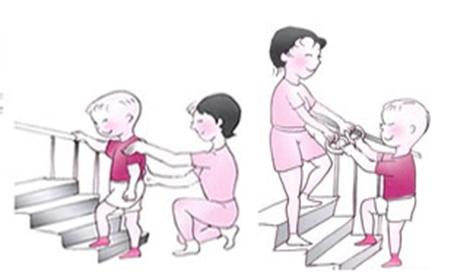 经颅磁刺激让1岁脑瘫娃娃终于站了起来