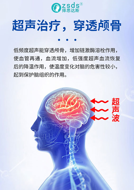 择思达斯经颅磁为什么很多人用?